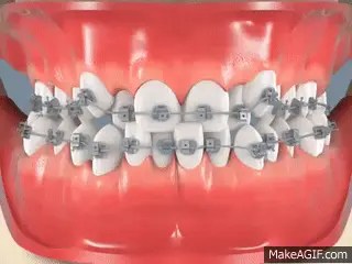 Dentista cerca de mí, dentista cerca de mí, mejor dentista de miami, mejor dentista de miami, pizza cerca de mí, chino cerca de mí, comida cerca de mí, dentista de corona en miami, dentista más barato en miami, dentista de tratamiento de conductos en miami, dentista de tratamiento de conductos en miami más barato